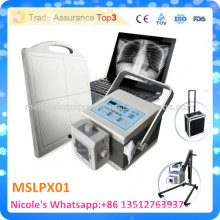 MSLPX01-i Full digital mini portable x ray machine/x-ray machine CE Approved